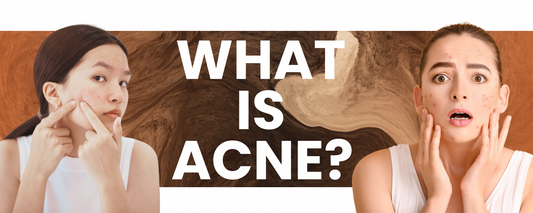 Know About Acne