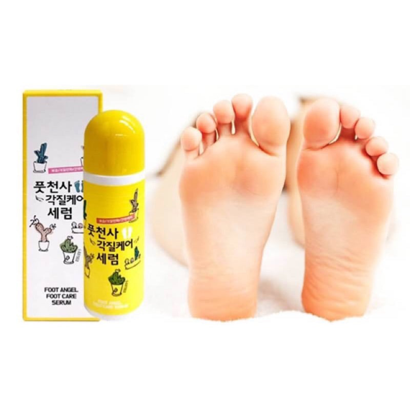 Foot Angel Callus Softening Roll-On Foot Care Essence (85ml)